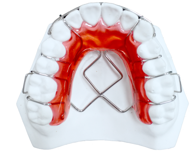 3m牙齿矫正器图片能看清哪些佩戴效果？-图1
