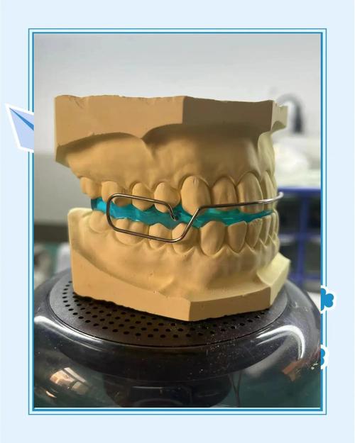 3m牙齿矫正器图片能看清哪些佩戴效果？-图3