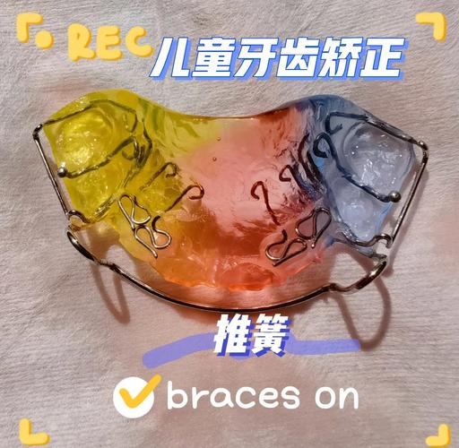 牙齿反颌活动矫正器的矫正效果究竟如何？-图2