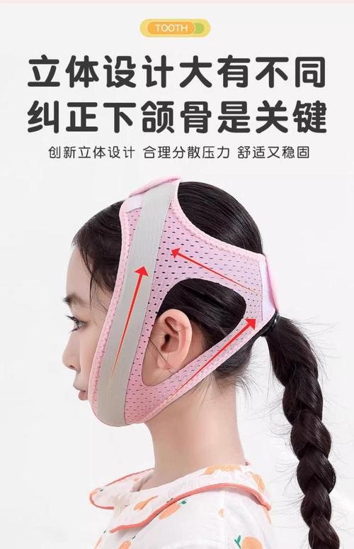 儿童牙齿反颌矫正器-图2