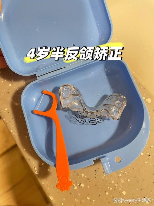 儿童活动牙齿矫正器，适用年龄、效果及注意事项有哪些？-图1