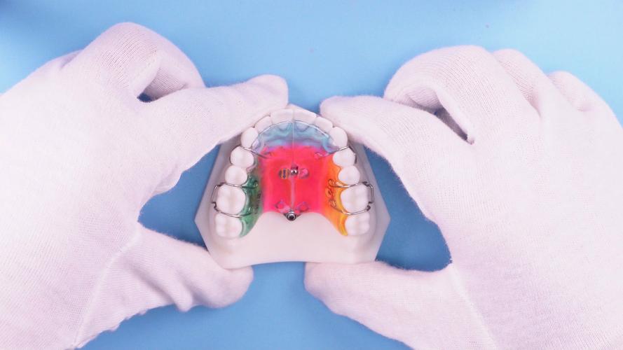 儿童活动牙齿矫正器，适用年龄、效果及注意事项有哪些？-图3