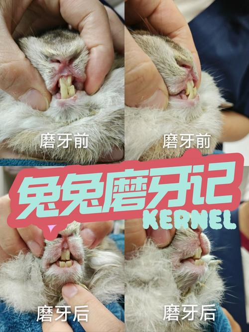 兔牙齿矫正前后图片，矫正效果究竟如何？-图2