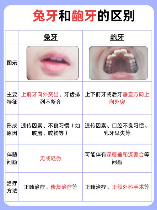 兔牙齿矫正前后图片，矫正效果究竟如何？-图1