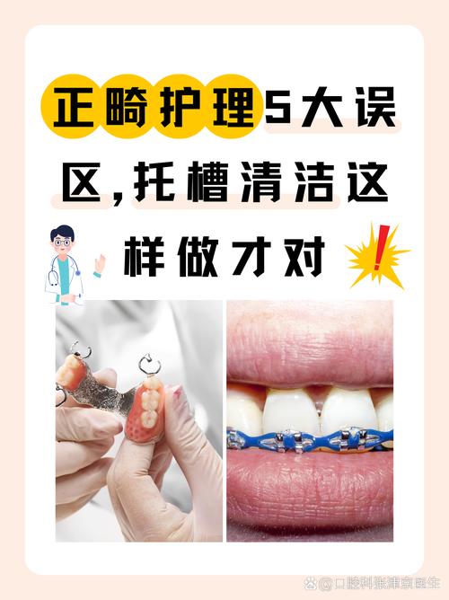 矫正牙齿前，洗牙是必须的吗？不洗会影响矫正效果吗？-图1