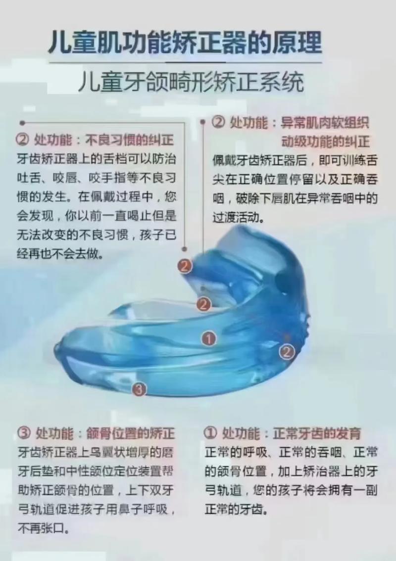 如何正确使用牙齿矫正器？佩戴时间与清洁注意事项有哪些？-图1