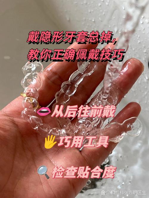 牙齿矫正器佩戴时会掉下来吗？-图2