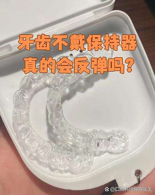 牙齿矫正器佩戴时会掉下来吗？-图3