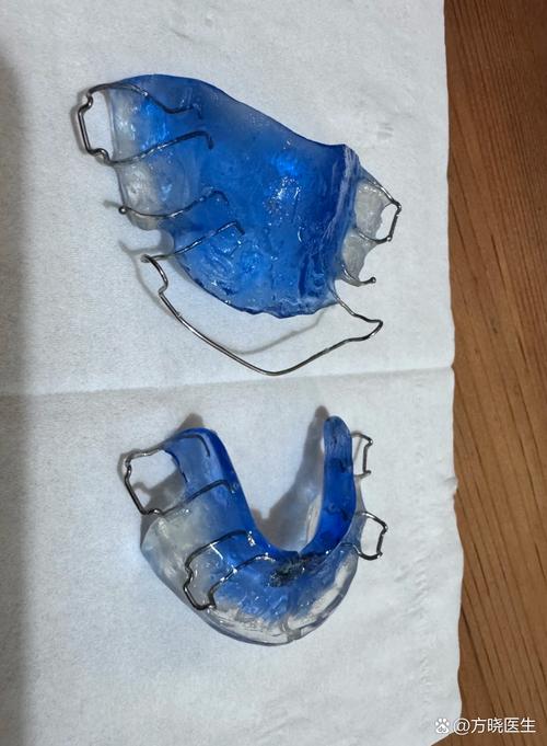 牙齿反颌矫正器图片能看清哪些细节？-图1