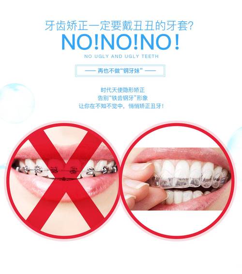 进口牙齿矫正器价格为何差异这么大？-图1