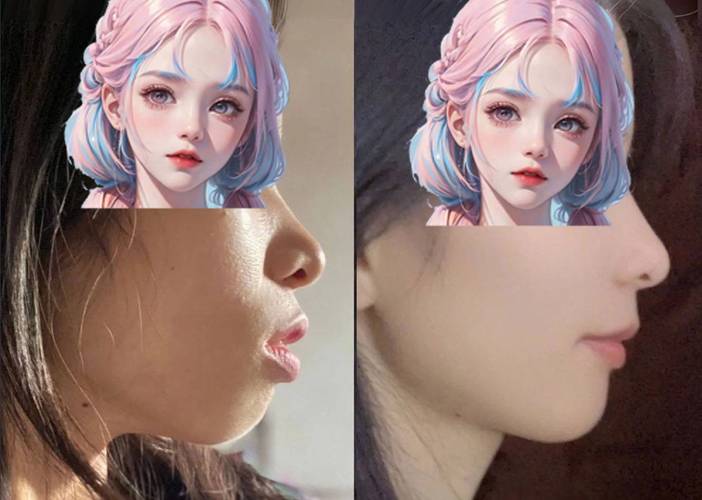 牙齿矫正后为何还嘴凸？矫正方案哪里出了问题？-图2