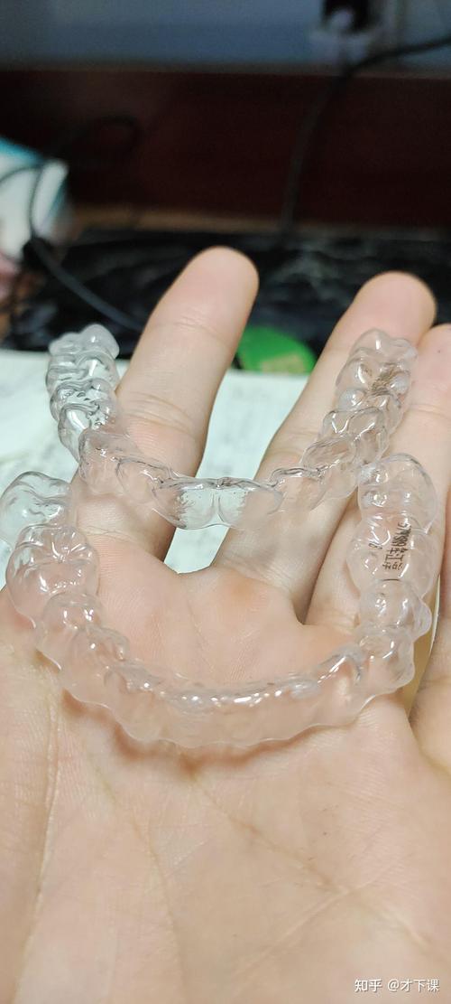 牙齿矫正后透明牙套，效果护理佩戴要注意啥？-图1