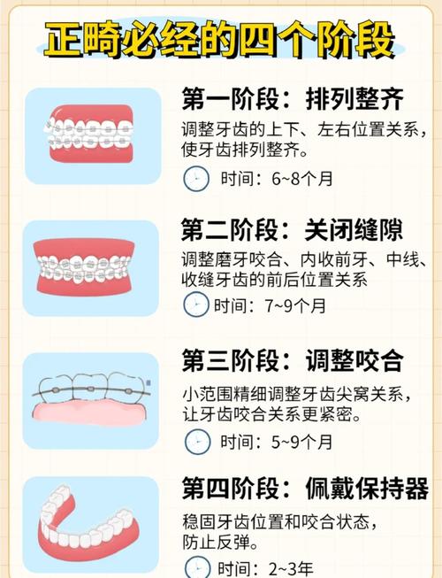 矫正牙齿上牙套的过程是怎样的？-图2