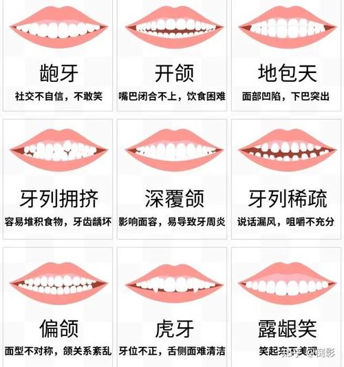 广东矫正牙齿费用大概多少？价格区间是怎样的？-图3