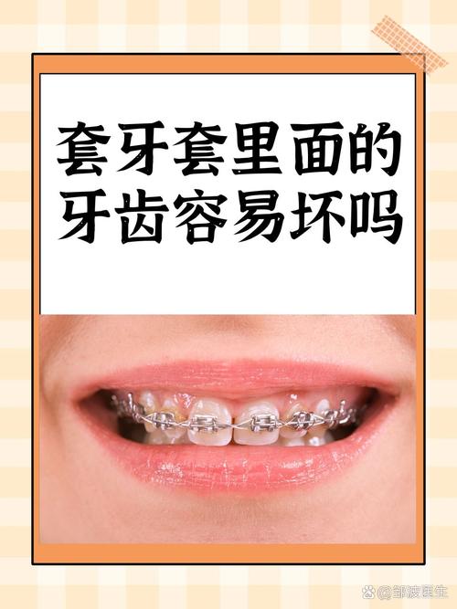 单颗牙齿能单独矫正吗？效果和邻牙有影响吗？-图3