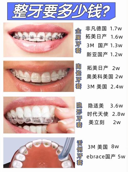 锦州牙齿矫正多少钱?费用受哪些因素影响?-图2 锦州牙齿矫正多少钱?费用受哪些因素影响?-图2