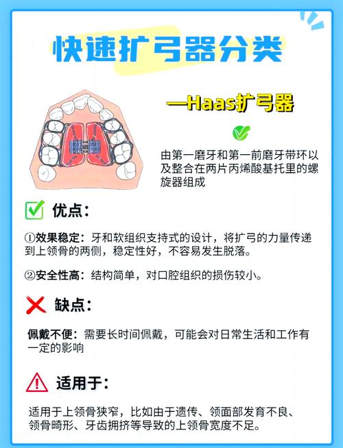 矫正牙齿扩弓的利弊-图3