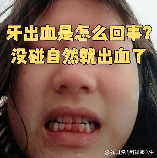 牙齿矫正后牙龈出血？原因何在？如何应对？-图2