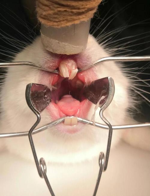 西安小白兔牙齿矫正靠谱吗？效果和价格怎么样？-图3