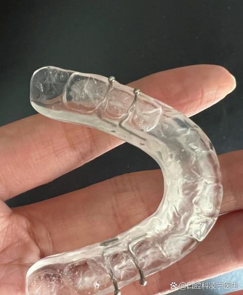 矫正牙齿后吃不了东西，是正常现象吗？怎么缓解？-图2