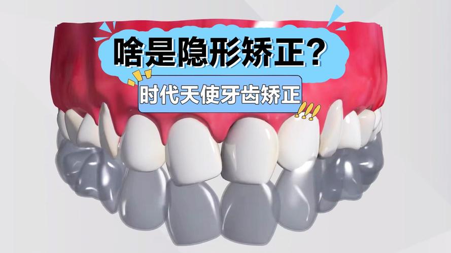 洛阳牙齿矫正哪家好？靠谱机构怎么选？-图2