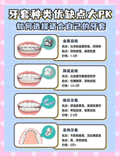 牙齿矫正有哪些阶段-图3