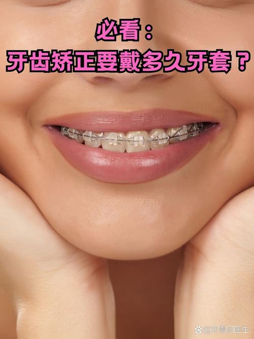 牙齿咬合矫正一般需要多长时间才能完成？-图1