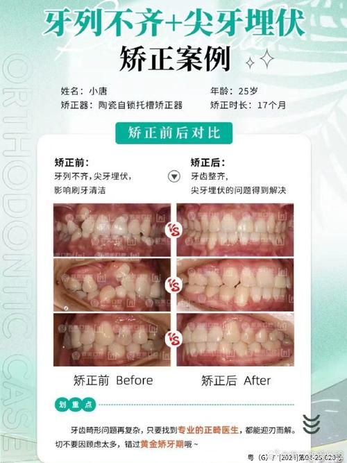 湛江牙齿矫正哪里好？求专业靠谱机构推荐和避坑经验分享！-图1
