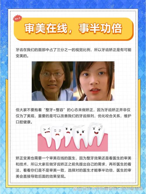 牙齿矫正几年不反弹-图3