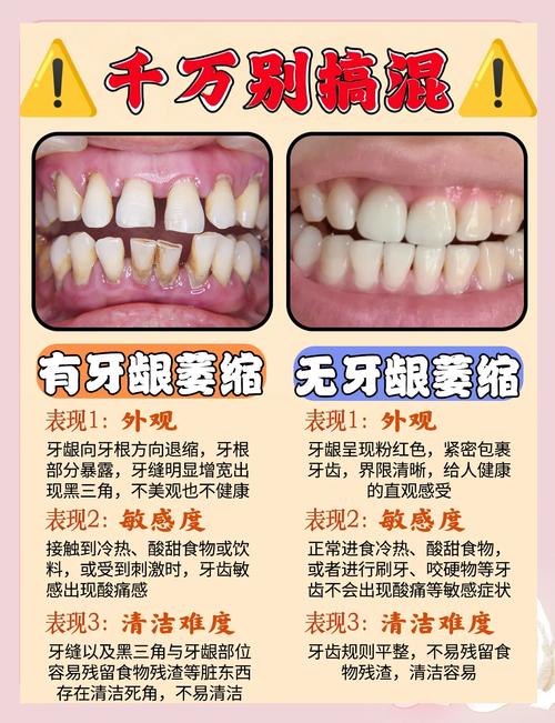 矫正牙齿说牙周萎缩-图1