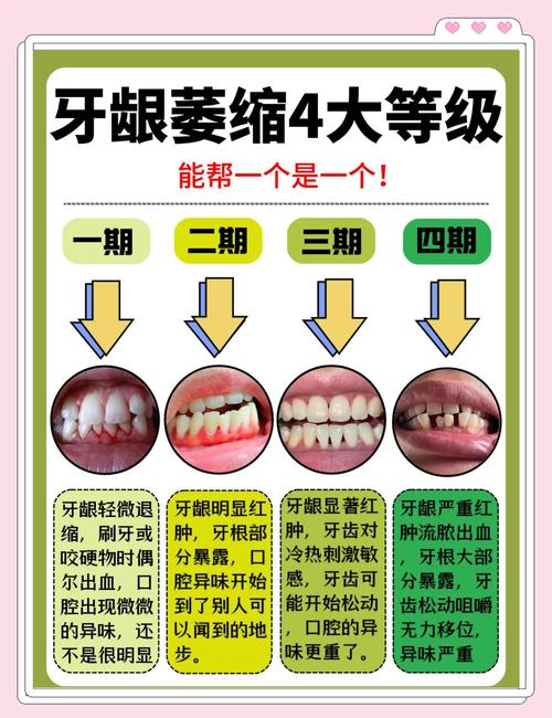 矫正牙齿说牙周萎缩-图2