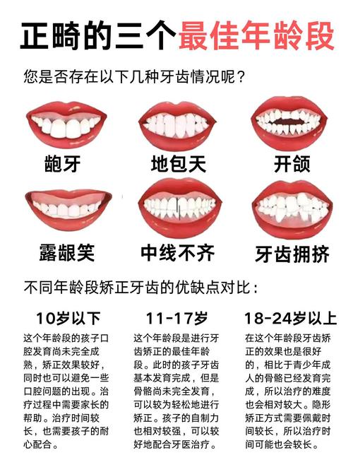 矫正牙齿的最迟年龄-图1