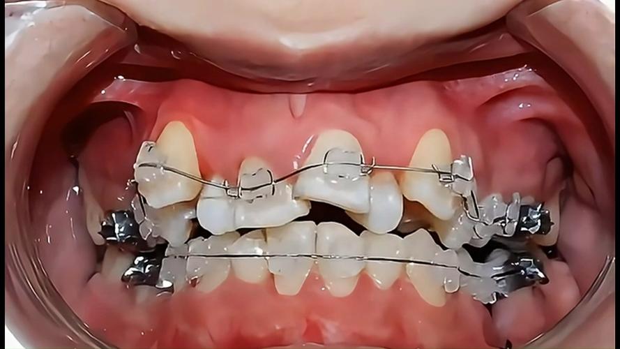 北京哪里牙齿矫正好-图1 北京哪里牙齿矫正好-图1