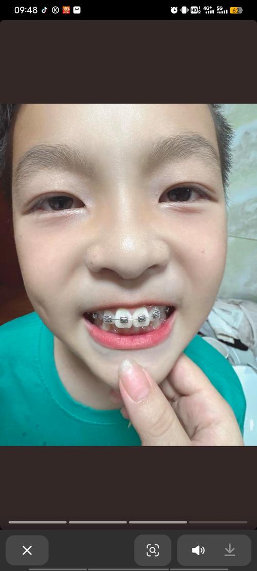 永川矫正牙齿哪里好-图1