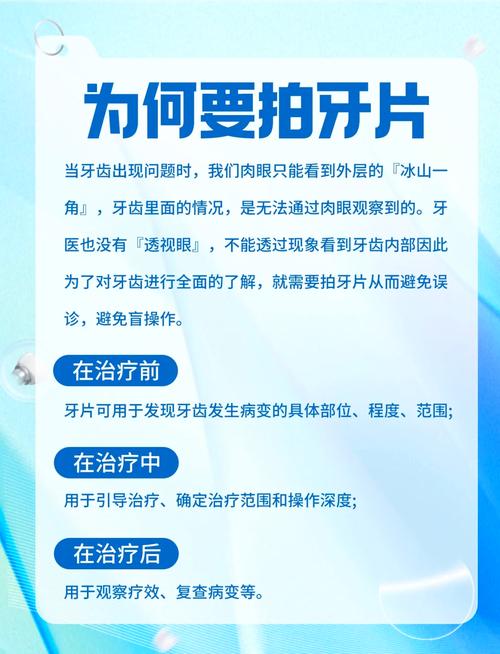 牙齿矫正必须拍片吗-图1