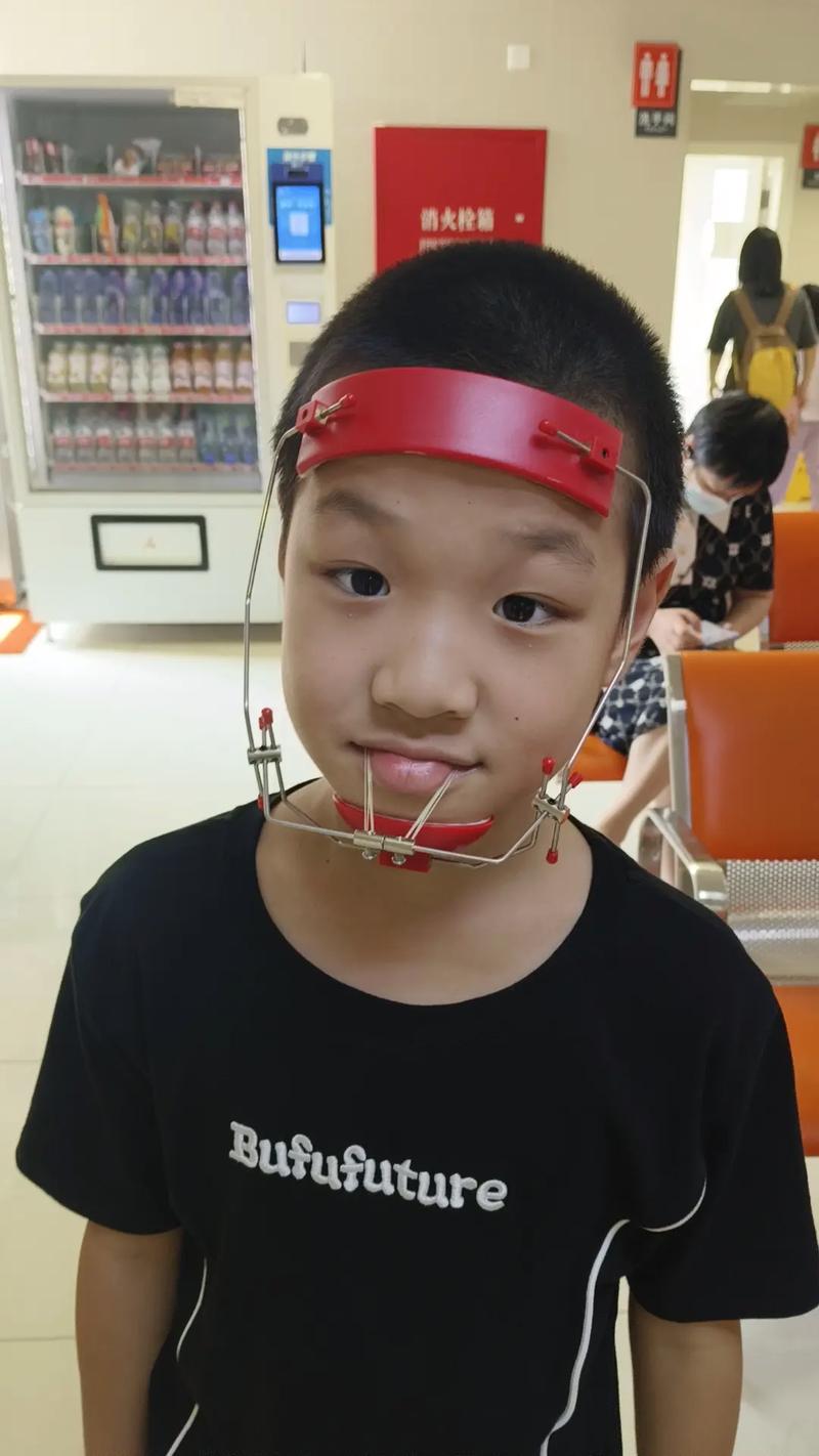 地包天牙齿怎样矫正-图2