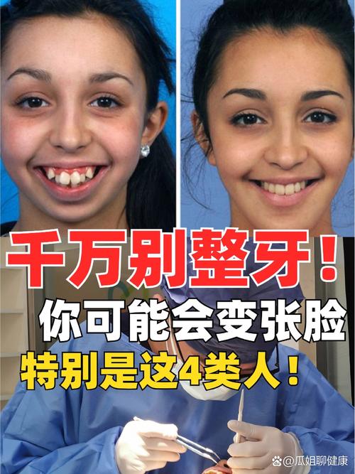 牙齿矫正后牙齿变长，是正常变化还是异常表现？该如何处理？-图1