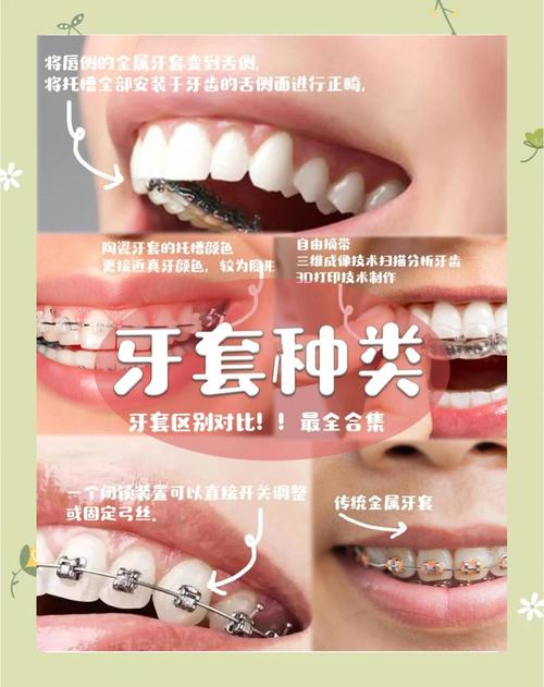 矫正牙齿去哪比较好-图3 矫正牙齿去哪比较好-图3