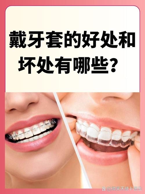 矫正牙齿必须戴牙套吗？还有其他矫正方式吗？-图1