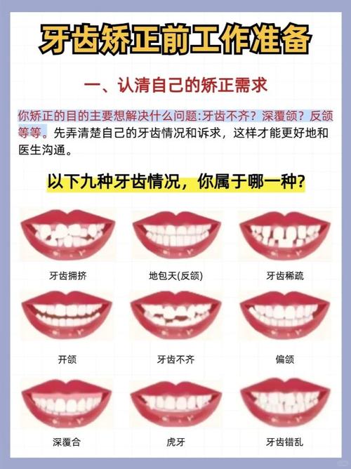 矫正牙齿前有哪些关键注意事项需要提前了解和准备？-图1