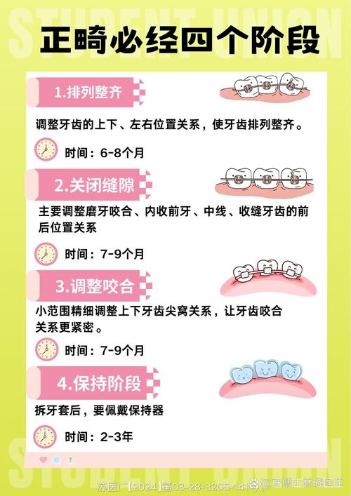 矫正牙齿前有哪些关键注意事项需要提前了解和准备？-图2
