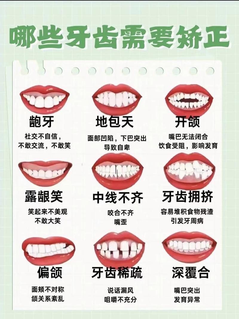 怎样的牙齿问题需要矫正？-图2