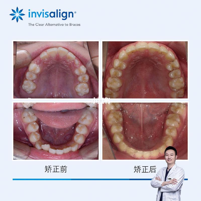 宁波矫正牙齿哪里好？求推荐靠谱机构！-图3