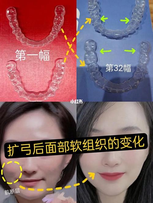 青岛哪里矫正牙齿好-图1