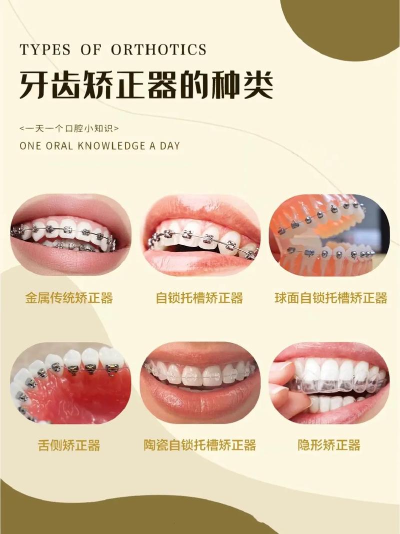 矫正牙齿去哪里好？公立私立怎么选？哪家更靠谱？-图2