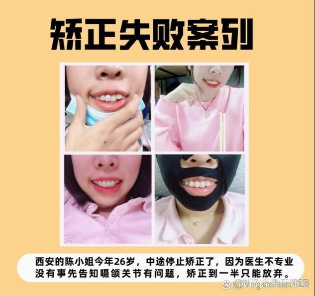 宁波矫正牙齿哪家好-图2