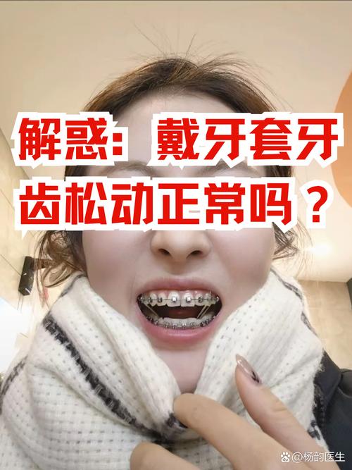 矫正牙齿松动是正常现象吗?-图1 矫正牙齿松动是正常现象吗?-图1