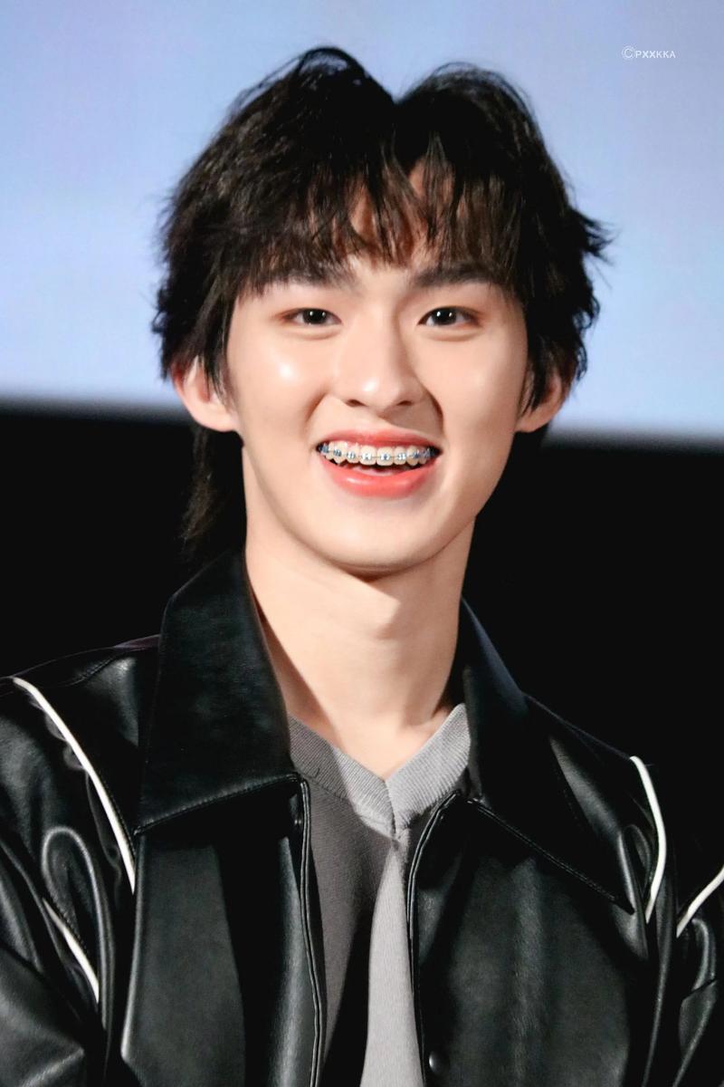 明星拔牙矫正为何成常态？效果真能带来惊艳改变吗？-图2