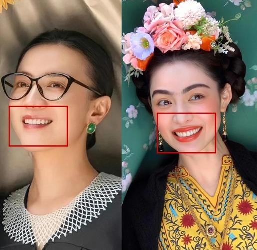 明星拔牙矫正为何成常态？效果真能带来惊艳改变吗？-图3