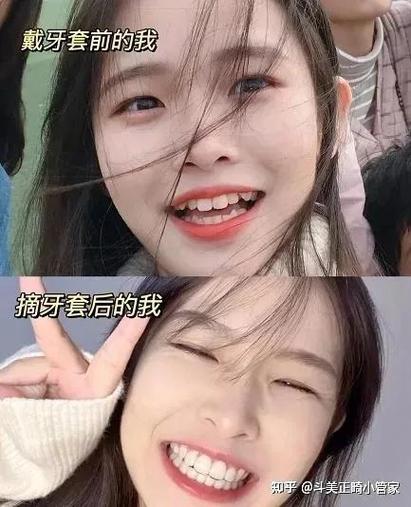 贵阳哪里矫正牙齿好-图2 贵阳哪里矫正牙齿好-图2
